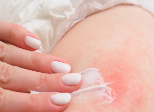 Jakie składniki w kosmetykach mogą pogarszać nawilżenie skóry z AZS?